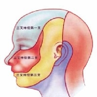 洛阳哪里治疗三叉神经痛效果好图1