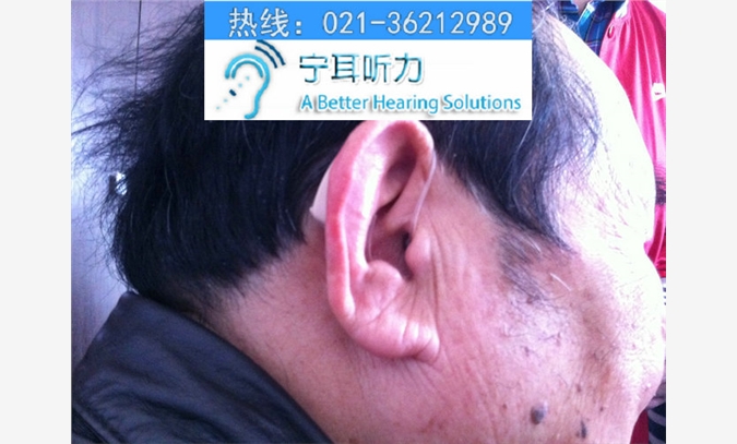 上海杨浦助听器折扣店哪里买助听器